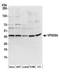 Detection of human and mouse VPS26A by western blot.