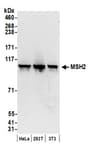 Detection of human and mouse MSH2 by western blot.