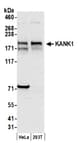 Detection of human KANK1 by western blot.