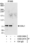 Detection of human GNL1 by western blot of immunoprecipitates.