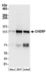 Detection of human CHERP by western blot.