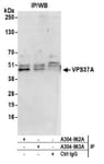 Detection of human VPS37A by western blot of immunoprecipitates.