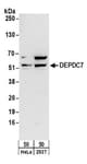 Detection of human DEPDC7 by western blot.