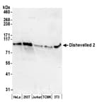 Detection of human and mouse Dishevelled 2 by western blot.