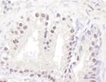 Detection of human ATM by immunohistochemistry.