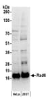 Detection of human Rad6 by western blot.