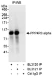 Detection of human PPP4R3 Alpha by western blot of immunoprecipitates.