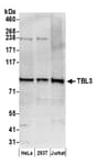 Detection of human TBL3 by western blot.