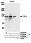 Detection of human EML4 by western blot of immunoprecipitates.