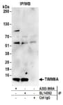 Detection of human TIMM8A by western blot of immunoprecipitates.