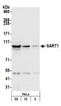 Detection of human SART1 by western blot.