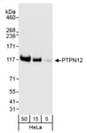 Detection of human PTPN12 by western blot.