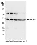 Detection of human and mouse HADHB by western blot.