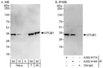 Detection of human and mouse OTUB1 by western blot (h&amp;m) and immunoprecipitation (h).