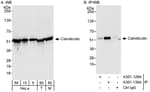 Detection of human and mouse Calreticulin by western blot (h&amp;m) and immunoprecipitation (h).