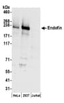 Detection of human Endofin by western blot.
