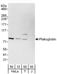 Detection of human Plakoglobin by western blot.