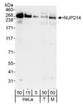 Detection of human and mouse NUP214 by western blot.