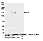 Detection of human GLI1 by western blot.