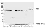 Detection of mouse ZEB1 by western blot.