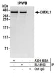 Detection of human DMXL1 by western blot of immunoprecipitates.