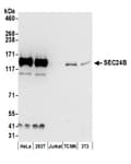 Detection of human and mouse SEC24B by western blot.