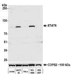 Detection of human STAT6 in FFPE breast carcinoma by immunohistochemistry.
