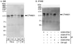 Detection of human and mouse CTNND1 by western blot (h&amp;m) and immunoprecipitation (h).