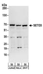 Detection of human SETD3 by western blot.