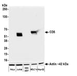 Detection of human CD5 by western blot.