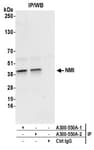 Detection of human NMI by western blot of immunoprecipitates.