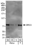 Detection of human ORC3 by western blot.