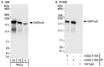 Detection of human GAPex5 by western blot and immunoprecipitation.