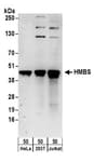 Detection of human HMBS by western blot.