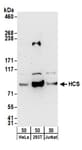 Detection of human HCS by western blot.