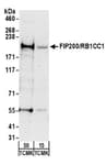 Detection of mouse FIP200/RB1CC1 by western blot.