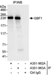 Detection of human GBF1 by western blot of immunoprecipitates.