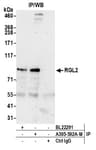 Detection of human RGL2 by western blot of immunoprecipitates.