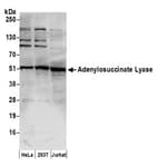 Detection of human Adenylosuccinate Lyase/ADSL by western blot.