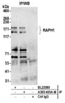 Detection of human RAPH1 by western blot of immunoprecipitates.