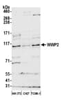 Detection of mouse WWP2 by western blot.