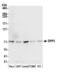 Detection of human and mouse DPP3 by western blot.