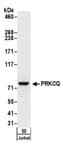 Detection of human PRKCQ by western blot.