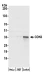 Detection of human CDK6 by western blot.