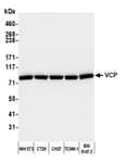 Detection of mouse VCP by western blot.