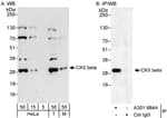 Detection of human and mouse CKII beta by western blot (h&amp;m) and immunoprecipitation (h).