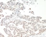 Detection of human NF110 by immunohistochemistry.