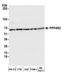 Detection of mouse PPP4R2 by western blot.