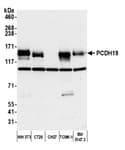 Detection of mouse PCDH19 by western blot.