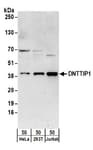 Detection of human DNTTIP1 by western blot.